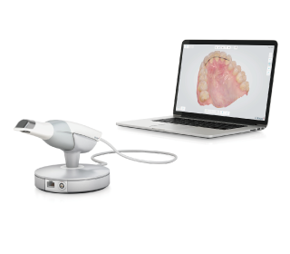 口腔内スキャナー